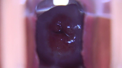 アジアの天使 19115