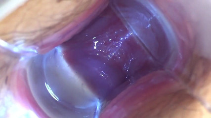 アジアン エンジェル 18787