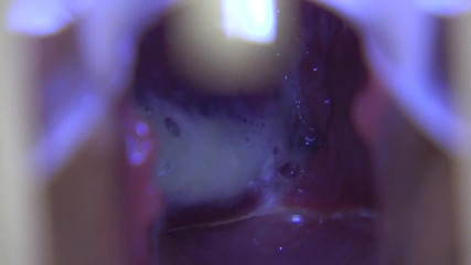 アジアの天使 17419